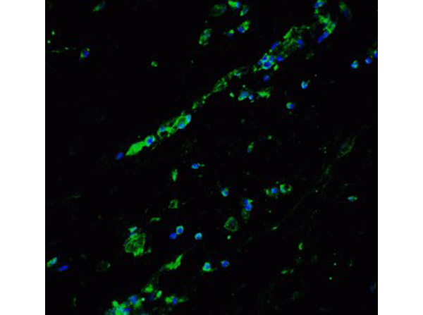BCL9L Antibody in Immunocytochemistry (ICC/IF)