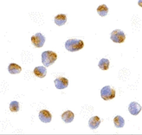 BCL-B Antibody in Immunocytochemistry (ICC/IF)