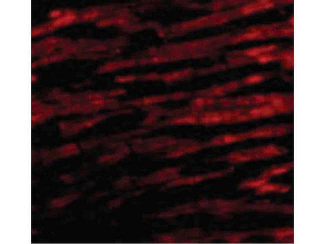 BCL-RAMBO Antibody in Immunocytochemistry (ICC/IF)