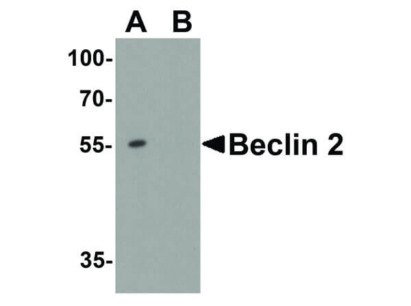 BECLIN2 Antibody in Western Blot (WB)