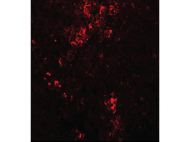 BFAR Antibody in Immunocytochemistry (ICC/IF)