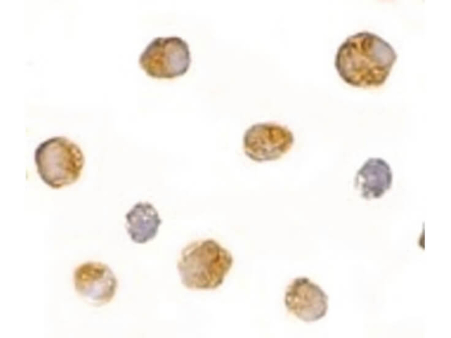 BICD1 Antibody in Immunocytochemistry (ICC/IF)