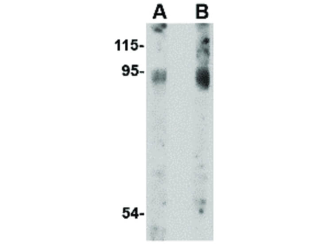 BICD2 Antibody in Western Blot (WB)