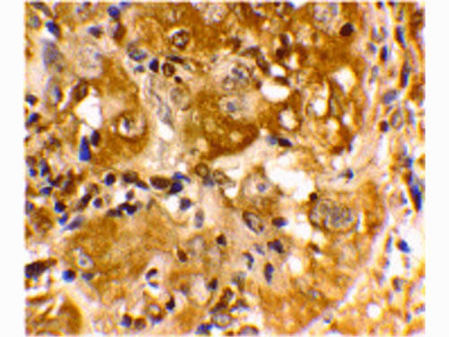 BIM Antibody in Immunohistochemistry (Paraffin) (IHC (P))