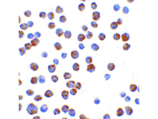 BIM Antibody in Immunocytochemistry (ICC/IF)
