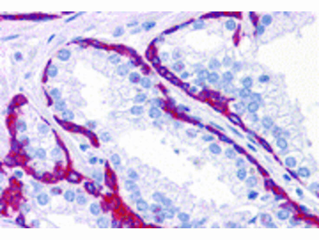 BMP15 Antibody in Immunohistochemistry (Paraffin) (IHC (P))