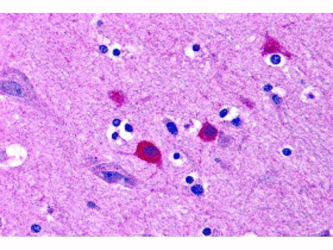BOK Antibody in Immunohistochemistry (Paraffin) (IHC (P))