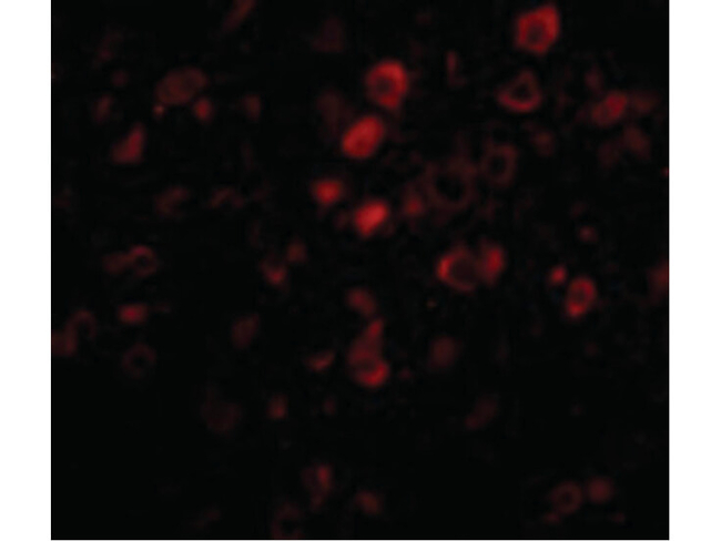 BORA Antibody in Immunocytochemistry (ICC/IF)