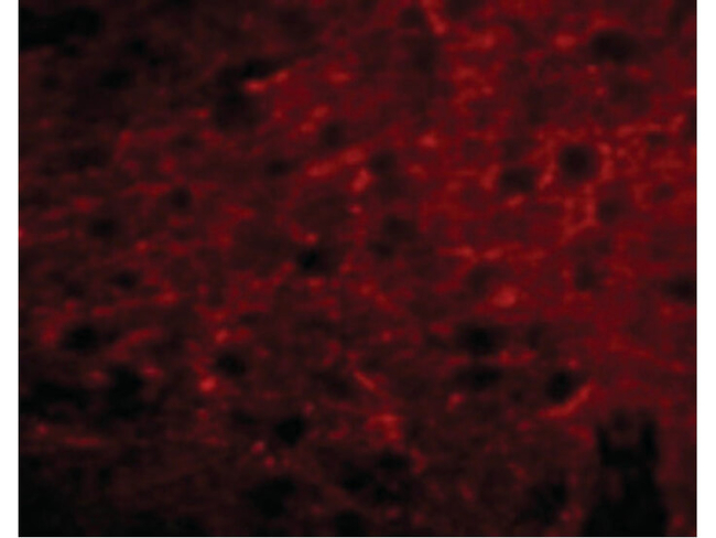 BORA Antibody in Immunocytochemistry (ICC/IF)