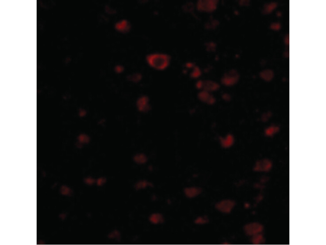 BRSK1 Antibody in Immunocytochemistry (ICC/IF)