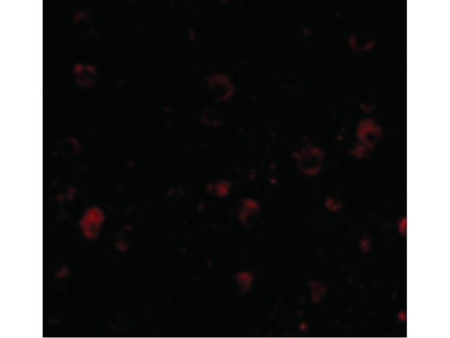 BRSK1 Antibody in Immunocytochemistry (ICC/IF)