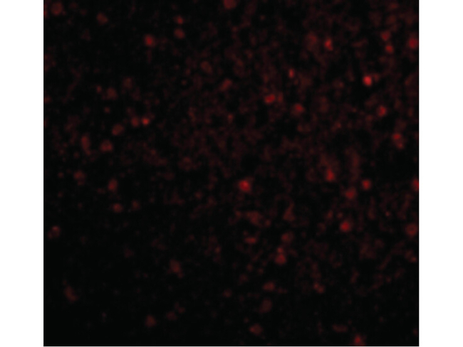 BRSK2 Antibody in Immunocytochemistry (ICC/IF)