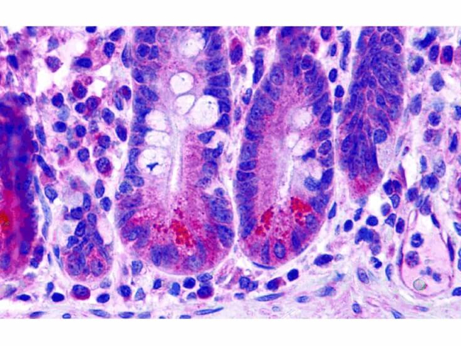BRUCE Antibody in Immunohistochemistry (Paraffin) (IHC (P))