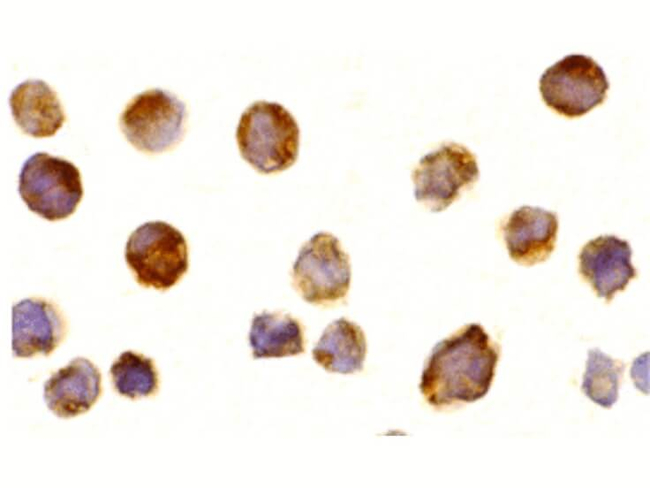 BTK Antibody in Immunocytochemistry (ICC/IF)