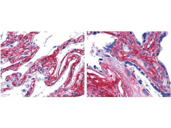 Collagen Type V Antibody in Immunohistochemistry (IHC)