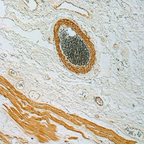Actin, Smooth Muscle Antibody in Immunohistochemistry (Paraffin) (IHC (P))
