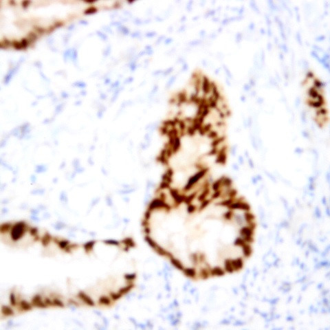 Phospho-P53 (Ser15) Antibody in Immunohistochemistry (Paraffin) (IHC (P))