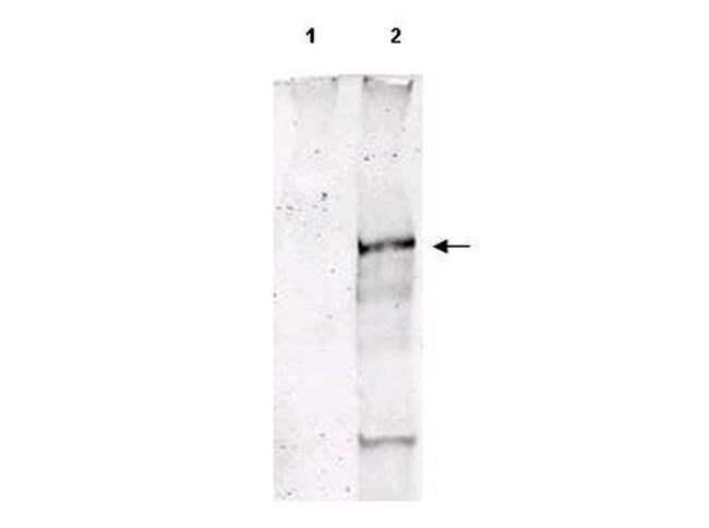 Phospho-ATM (Ser1981) Antibody in Western Blot (WB)