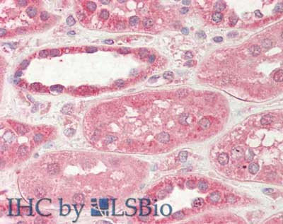 STIM2 Antibody in Immunohistochemistry (Paraffin) (IHC (P))