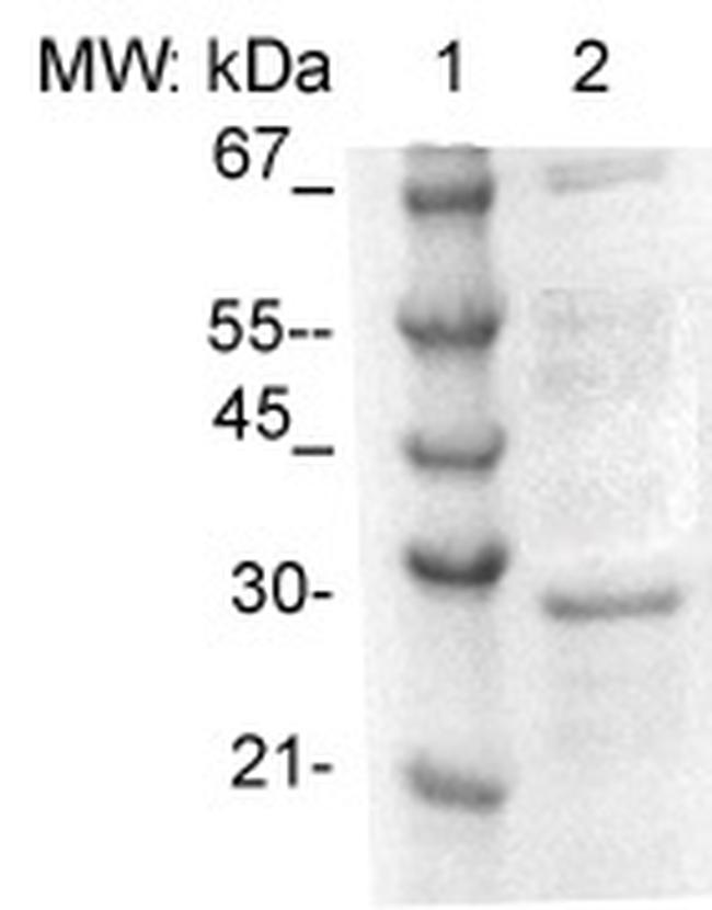 Tpd52 (Tumor Protein D52) Antibody in Western Blot (WB)