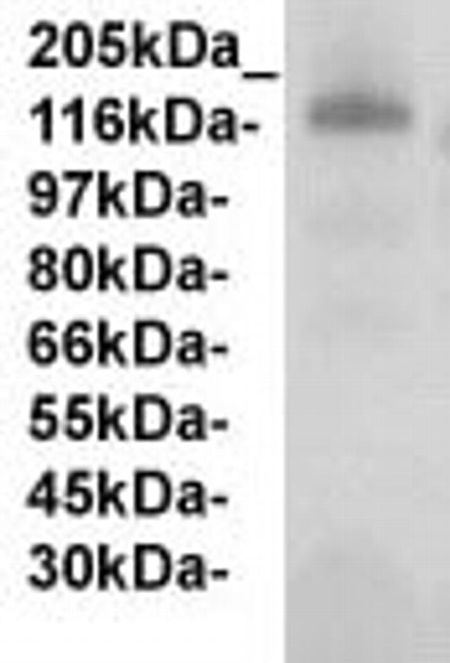 Fibulin-2 Antibody in Western Blot (WB)