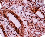 Legumain Antibody in Immunohistochemistry (PFA fixed) (IHC (PFA))