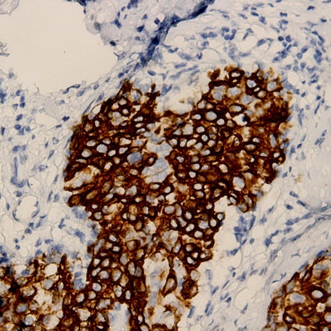 PSA Antibody in Immunohistochemistry (Paraffin) (IHC (P))