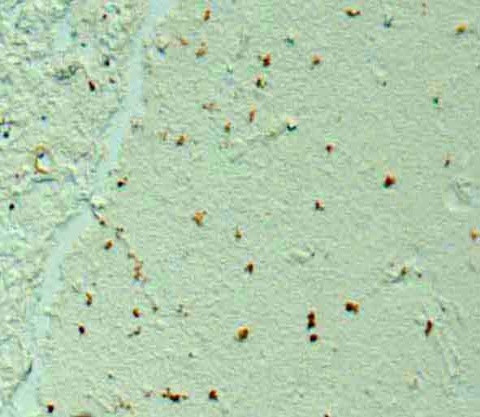 Amyloid beta 42 Antibody in Immunohistochemistry (Paraffin) (IHC (P))