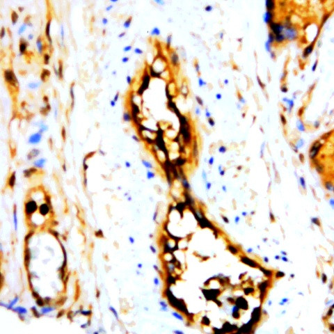 L-Plastin Antibody in Immunohistochemistry (Paraffin) (IHC (P))