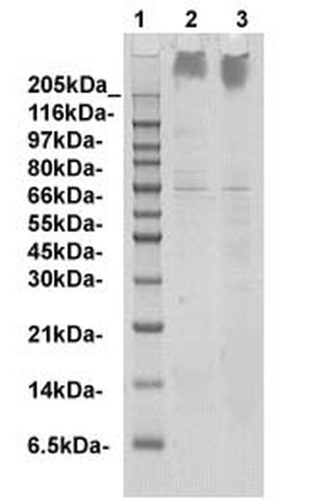 Plectin Antibody in Western Blot (WB)