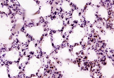 Tenascin C Antibody in Immunohistochemistry (Paraffin) (IHC (P))