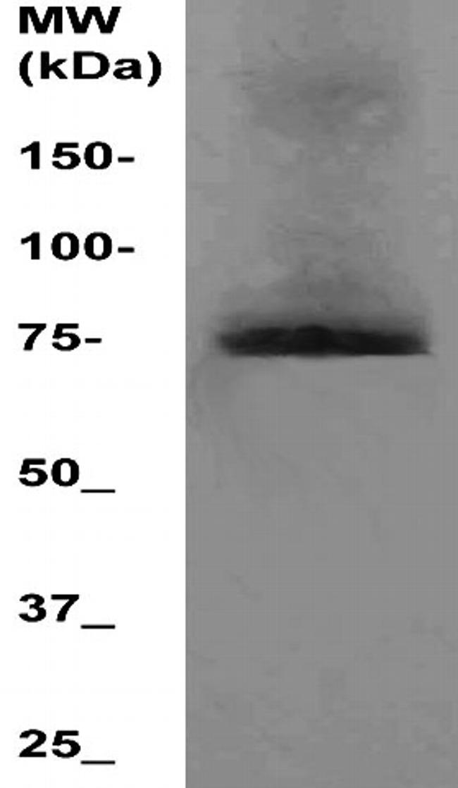 Pdia 4 Antibody in Western Blot (WB)