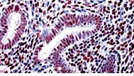 EWSR Antibody in Immunohistochemistry (Paraffin) (IHC (P))