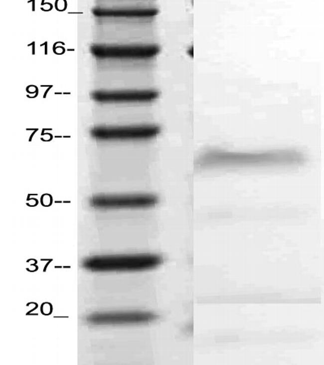 Selectin E Antibody in Western Blot (WB)