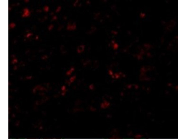 AP2M1 Antibody in Immunocytochemistry (ICC/IF)