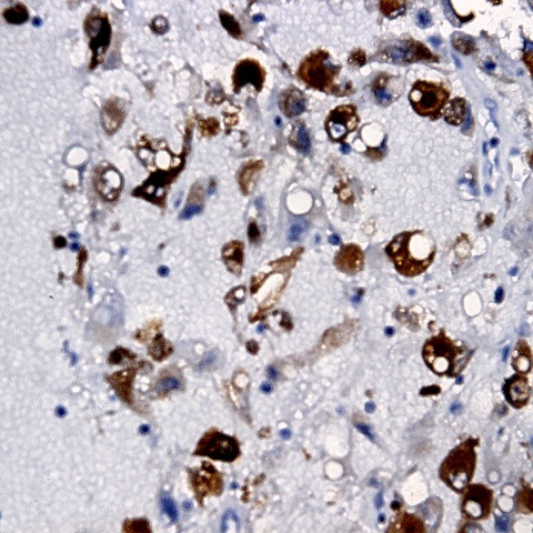 CD117 (c-kit) Antibody in Immunohistochemistry (Paraffin) (IHC (P))