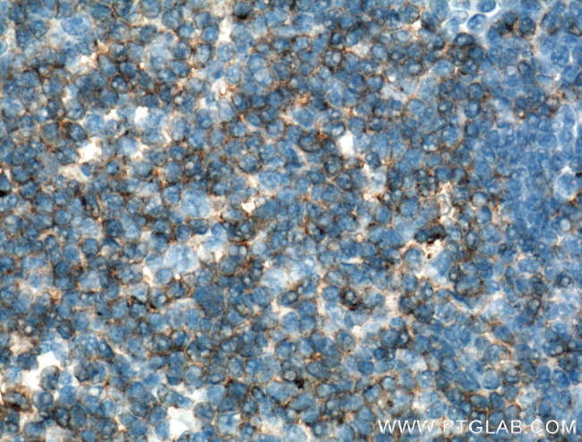 CD2 Antibody in Immunohistochemistry (Paraffin) (IHC (P))