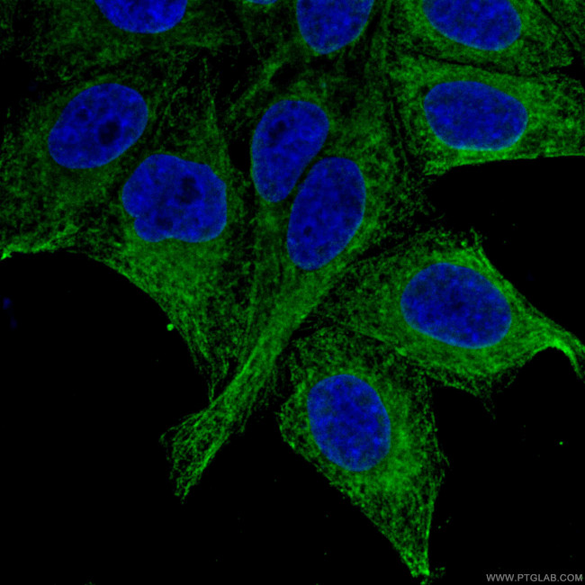 GRP94 Antibody in Immunocytochemistry (ICC/IF)