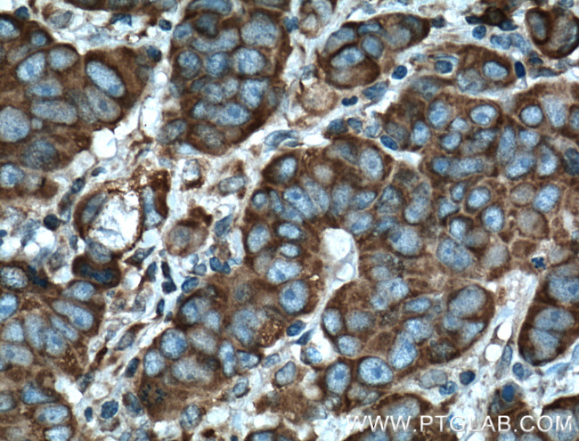 DHCR24 Antibody in Immunohistochemistry (Paraffin) (IHC (P))