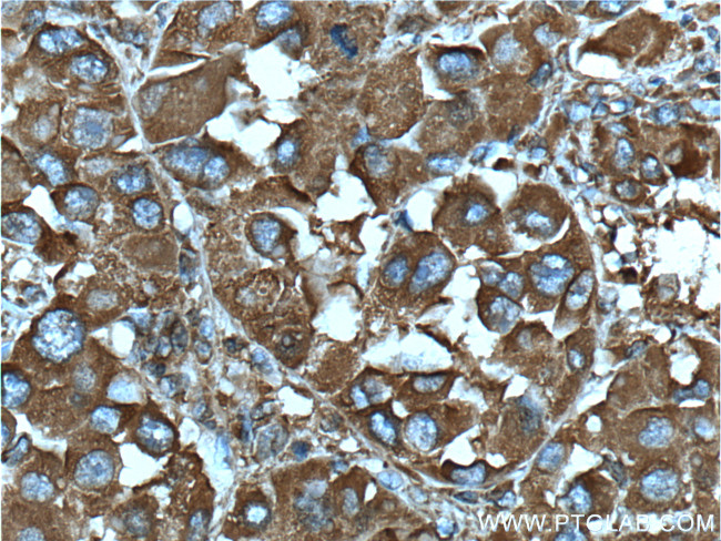 DSE Antibody in Immunohistochemistry (Paraffin) (IHC (P))