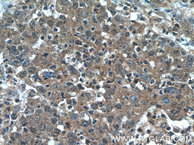 Transgelin 2 Antibody in Immunohistochemistry (Paraffin) (IHC (P))