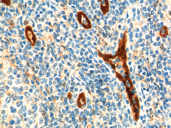 ACKR2 Antibody in Immunohistochemistry (Paraffin) (IHC (P))