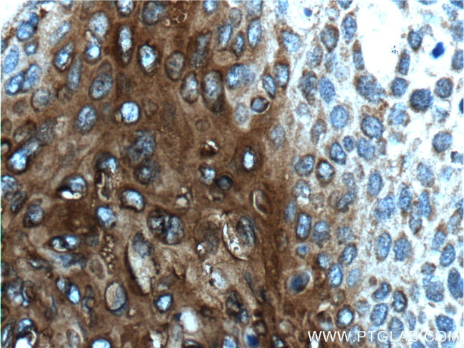 MAGEA3 Antibody in Immunohistochemistry (Paraffin) (IHC (P))