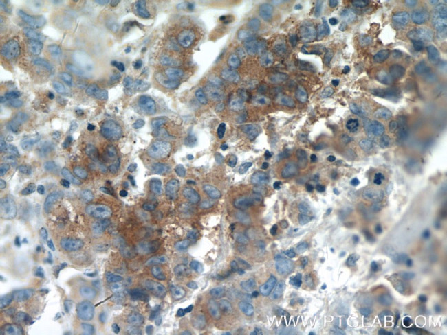 Syntaxin 6 Antibody in Immunohistochemistry (Paraffin) (IHC (P))