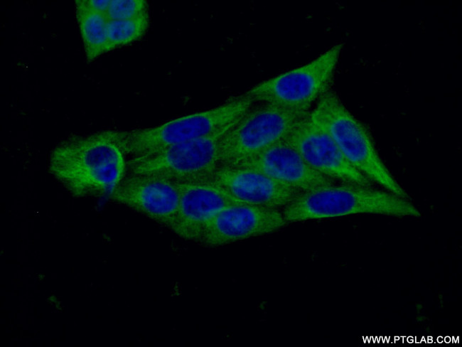 ATG5 Antibody in Immunocytochemistry (ICC/IF)