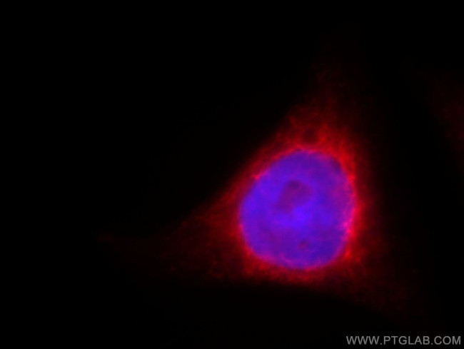 GMF-beta Antibody in Immunocytochemistry (ICC/IF)