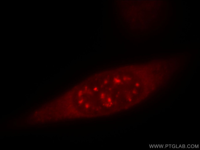 IL18 Antibody in Immunocytochemistry (ICC/IF)