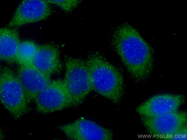 GDI2 Antibody in Immunocytochemistry (ICC/IF)