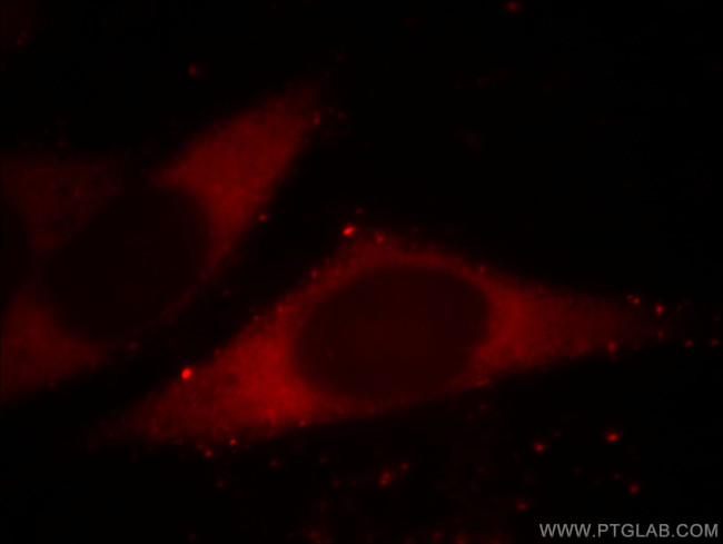 BORIS Antibody in Immunocytochemistry (ICC/IF)