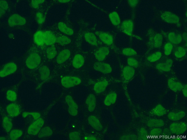 DACH1 Antibody in Immunocytochemistry (ICC/IF)